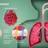 Interstitial Lung Diseases image 1